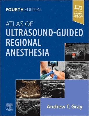 Andrew T. Gray - Atlas of Ultrasound-Guided Regional Anesthesia, Inbunden