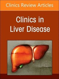 bokomslag Alcohol-Associated Liver Disease, An Issue of Clinics in Liver Disease