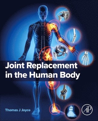 Joint Replacement in the Human Body 1