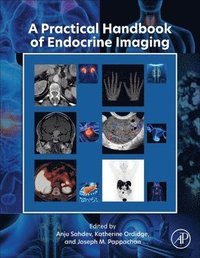 bokomslag A Practical Handbook of Endocrine Imaging