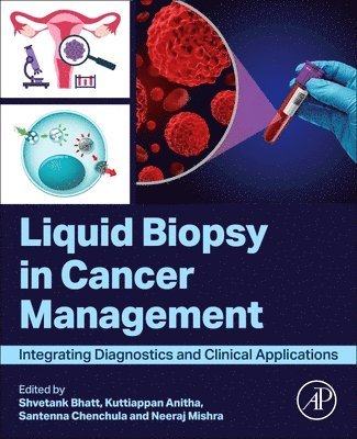 Shvetank Bhatt, Kuttiappan Anitha, Santenna Chenchula, Neeraj Mishra - Liquid biopsy in Cancer Management, Häftad
