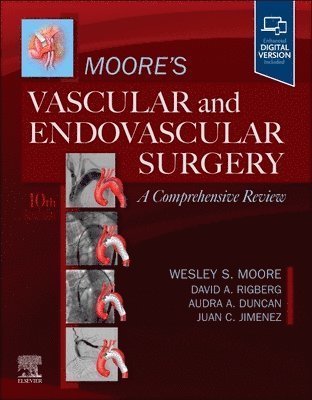 Wesley S. Moore - Moore's Vascular and Endovascular Surgery: A Comprehensive Review, Häftad