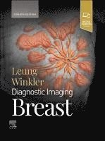 bokomslag Diagnostic Imaging: Breast