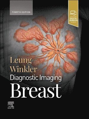 Jessica W. T. Leung, Nicole S. Winkler - Diagnostic Imaging: Breast, Inbunden