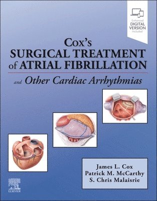 James Cox, S. Chris Malaisrie, Patrick M. McCarthy, USA) Cox, James (Cardiac Surgeon and Director of Atrial Fibrillation Program, Professor of Surgery, Northwestern University, USA) Malaisrie, S. Chris (Cardiac Surgeon and Director of Academic Affairs, Professor of Surgery, Northwestern University, USA) McCarthy, Patrick M. (Cardiac Surgeon and Executive Director, Bluhm Cardiovascular Institute, Professor of Surgery, Northwestern University, Patrick M. Mccarthy - Cox's Surgical Treatment of Atrial Fibrillation, Häftad