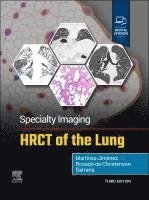 bokomslag Specialty Imaging: HRCT of the Lung