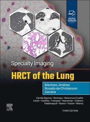 bokomslag Specialty Imaging: HRCT of the Lung