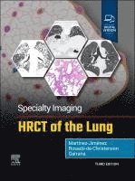 Santiago Mart�nez-Jim�nez, Melissa L. Rosado-de-Christenson, Sherief Garrana, Santiago Martínez-Jiménez, USA) Martinez-Jimenez, Santiago, MD (Department of Radiology, Saint Luke's Hospital of Kansas City, Professor of Radiology, University of Missouri-Kansas City School of Medicine, Kansas City, Missouri, USA) Rosado-de-Christenson, Melissa L., MD, FACR, FAAWR (Melissa L. Rosado-de-Christenson, MD, FACR, FAAWR, Attending Radiologist, Division of Cardiothoracic Imaging, Department of Medical Imaging, Banner - University Medical Group Tucson, Professor of Medical Imaging, University of Arizona College of Medicine - Tucson, Tucson, Arizona, USA) Garrana, Sherief, MD (Clinical Assistant Professor of Radiology, Division of Thoracic Imaging, Department of Radiology, NYU Langone Health, New York, NY, Melissa L. Rosado-De-Christenson, Melissa L Rosado-De-Christenson - Specialty Imaging: HRCT of the Lung, Inbunden