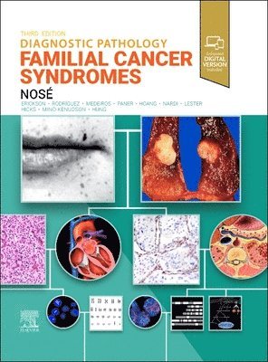 Vania Nos� - Diagnostic Pathology: Familial Cancer Syndromes, Inbunden