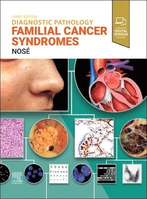 Vania Nos�, Vania Nosé, USA) Nose, Vania, MD, PhD (Professor of Pathology, Harvard Medical School, Pathologist and Consultant in Endocrine Pathology and Familial Syndromes, Massachusetts General Hospital, Boston, Massachusetts - Diagnostic Pathology: Familial Cancer Syndromes, Inbunden