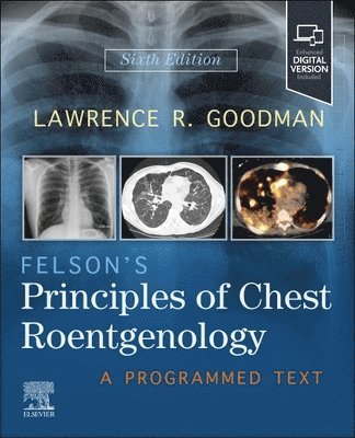 Felson's Principles of Chest Roentgenology