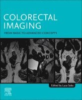 Luca Saba - Colorectal Imaging, Häftad