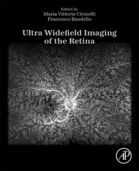 bokomslag Ultra Widefield Imaging of the Retina