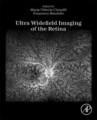 Maria Vittoria Cicinelli, Francesco Bandello - Ultra Widefield Imaging of the Retina, Häftad