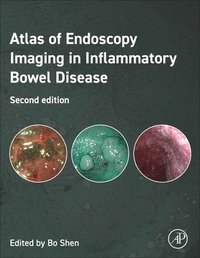 bokomslag Atlas of Endoscopy Imaging in Inflammatory Bowel Disease