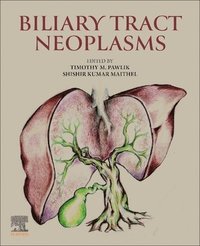 bokomslag Biliary Tract Neoplasms