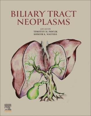 Timothy M. Pawlik, Shishir K. Maithel - Biliary Tract Neoplasms, Häftad
