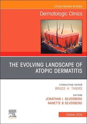 bokomslag The Evolving Landscape of Atopic Dermatitis, An Issue of Dermatologic Clinics