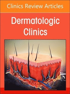 The Evolving Landscape of Atopic Dermatitis, An Issue of Dermatologic Clinics 1