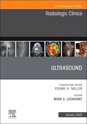 Ultrasound, An Issue of Radiologic Clinics of North America