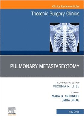 bokomslag Pulmonary Metastasectomy, An Issue of Thoracic Surgery Clinics