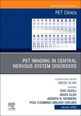 PET Imaging in Central Nervous System Disorders, An Issue of PET Clinics 1