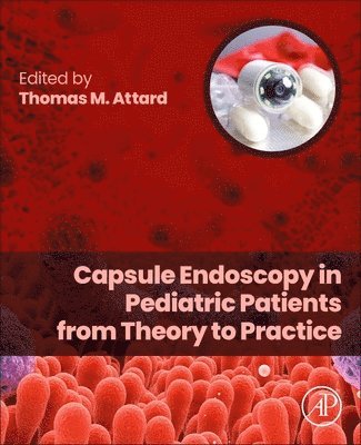 Thomas M. Attard - Capsule Endoscopy in Pediatric Patients from Theory to Practice, Häftad
