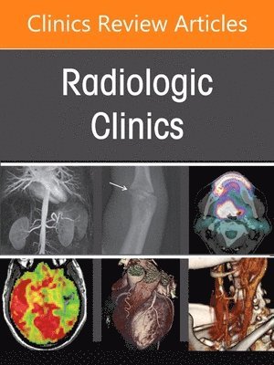 bokomslag Pearls and Pitfalls in Thoracic Disease Imaging, An Issue of Radiologic Clinics of North America