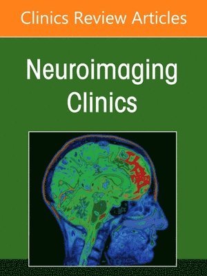 Agarwal,Nivedit, Nivedita Agarwal, Anja van der Kolk, ITALY) Agarwal, Nivedita (Neuroradiologist, Head of Radiology & Neuroradiology Unit Scientific Institute, The Netherlands) Kolk, Anja van der, MD PhD (Department of Medical Imaging, Radboudumc, Anja Van Der Kolk - Imaging of Neurofluids, An Issue of Neuroimaging Clinics of North America, Inbunden