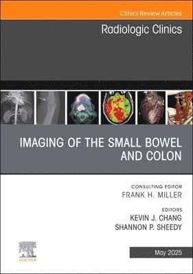 bokomslag Imaging of the Small Bowel and Colon, An Issue of Radiologic Clinics of North America