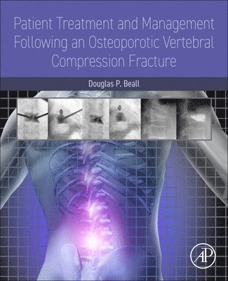 bokomslag Patient Treatment and Management Following an Osteoporotic Vertebral Compression Fracture