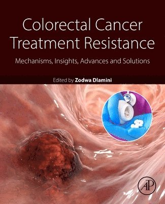 bokomslag Colorectal Cancer Treatment Resistance