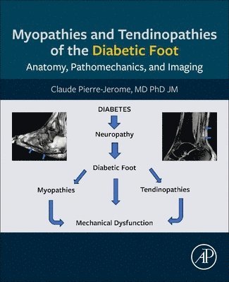 Myopathies and Tendinopathies of the Diabetic Foot 1