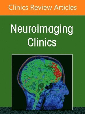 bokomslag Management and Treatment of Cerebral Aneurysms, An Issue of Neuroimaging Clinics of North America