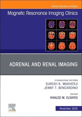 Khaled M. Elsayes, USA) Elsayes, Khaled M. (MD Anderson Distinguished Educator, Professor, Department of Abdominal Imaging, University of Texas M.D. Anderson Cancer Center, Houston, TX, Khaled M Elsayes - Adrenal and Renal Imaging, An Issue of Magnetic Resonance Imaging Clinics of North America, Inbunden