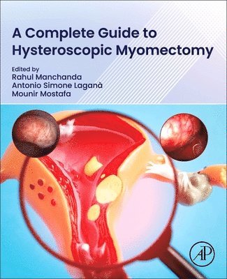 Rahul Manchanda, Antonio Simone Lagan�, Mounir Mostafa - A Complete Guide to Hysteroscopic Myomectomy, Häftad