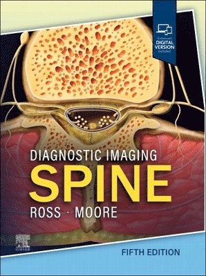 Jeffrey S. Ross, Kevin R. Moore - Diagnostic Imaging: Spine, Inbunden