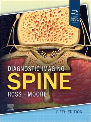 Jeffrey S. Ross, Kevin R. Moore, USA) Ross, Jeffrey S. (Consultant, Neuroradiology Division, Department of Radiology, Mayo Clinic Arizona, Professor of Radiology, Mayo Clinic College of Medicine, Phoenix, Arizona, USA) Moore, Kevin R. (Pediatric Radiologist and Neuroradiologist, Intermountain Pediatric Imaging, Primary Children's Hospital, Adjunct Professor of Radiology, University of Utah School of Medicine, Salt Lake City, Utah - Diagnostic Imaging: Spine, Inbunden