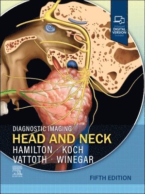 Bronwyn E. Hamilton, Bernadette L. Koch, Surjith Vattoth, Blair A. Winegar - Diagnostic Imaging: Head and Neck, Inbunden