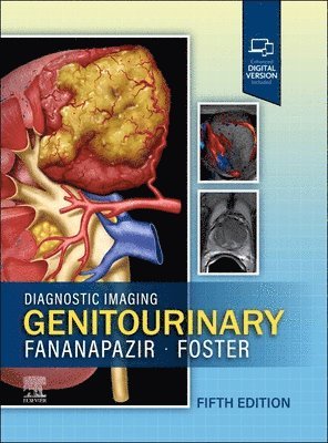 Ghaneh Fananapazir, Bryan R. Foster - Diagnostic Imaging: Genitourinary, Inbunden
