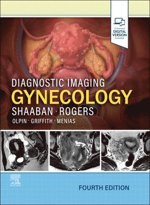 Akram M. Shaaban, Douglas Rogers - Diagnostic Imaging: Gynecology, Inbunden
