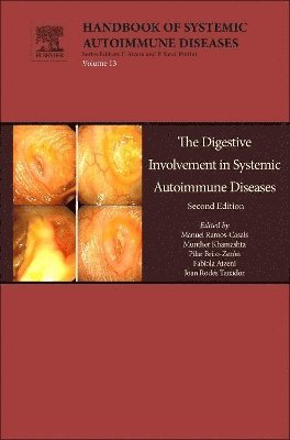 bokomslag The Digestive Involvement in Systemic Autoimmune Diseases