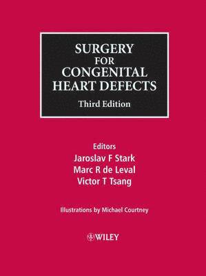 Surgery for Congenital Heart Defects 1