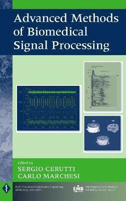 Sergio Cerutti, Carlo Marchesi - Advanced Methods of Biomedical Signal Processing, Inbunden