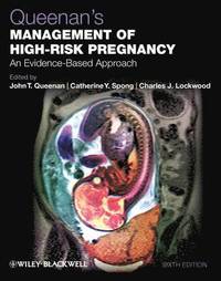 bokomslag Queenan's Management of High-Risk Pregnancy