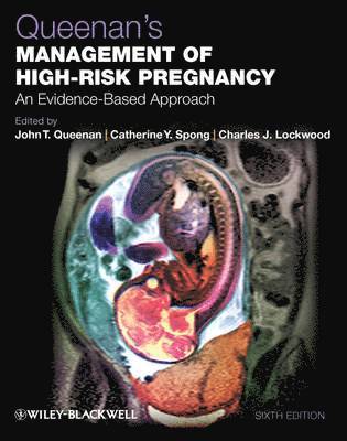Queenan's Management of High-Risk Pregnancy 1