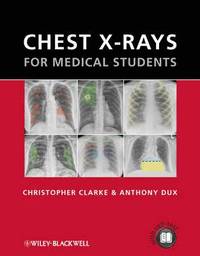 bokomslag Chest X-rays for Medical Students