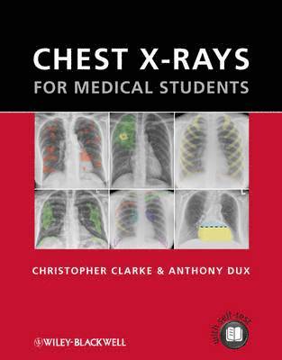 bokomslag Chest X-rays for Medical Students