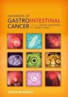 Janusz A. Z. Jankowski, Ernest Hawk - Handbook of Gastrointestinal Cancer, Häftad