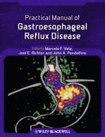 bokomslag Practical Manual of Gastroesophageal Reflux Disease